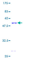 12.5% SDS-PAGE Stained with Coomassie Blue.